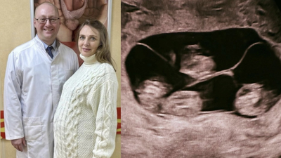 ‘One in 15.5 million’: Woman in Russia gives birth to four identical girls | World News