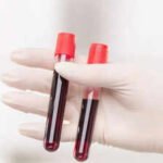 World’s rarest hybrid blood type discovered in Thailand: Study found in just 3 people out of a massive research of 544,000 samples | World News