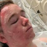 McDonald’s worker left in ICU after colleague throws scalding oil on him, mother launches fundraiser: ‘The pain he’s experiencing…’
