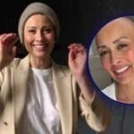 Melanie Sykes reveals her bald look, following the diagnosis of Alopecia: ‘Loss + Gain = Life |