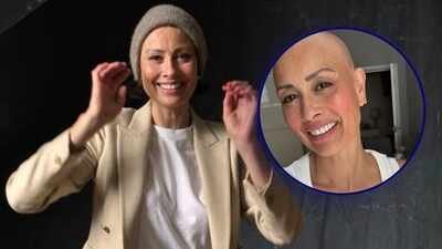 Melanie Sykes reveals her bald look, following the diagnosis of Alopecia: ‘Loss + Gain = Life |