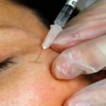 Zombie filler: Dead people’s fat is the latest beauty trend