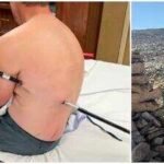 A man impales himself on trekking pole while climbing Montana’s highest peak, hikes 10 miles to safety instead of calling a helicopter