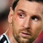 No easy wins in FIFA World Cup: Lionel Scaloni says ‘suffering part of our DNA’ as Argentina survive Switzerland scare | Football News