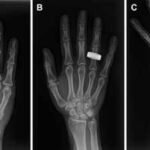 For the first time in history, astronauts use portable X-ray technology in space that could pave the way for future Moon and Mars missions |