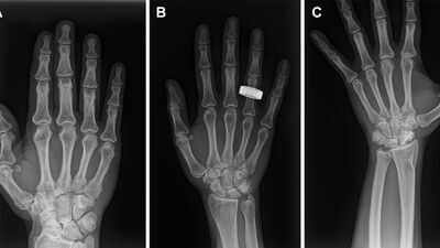 For the first time in history, astronauts use portable X-ray technology in space that could pave the way for future Moon and Mars missions |