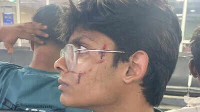 IP University PRO’s son allegedly attacked by neighbours in Dwarka, FIR not registered yet