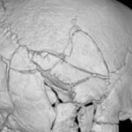 A skeleton found beneath Scotland’s Stirling Castle had more than 160 fractures; researchers say it is the first confirmed death from a trebuchet
