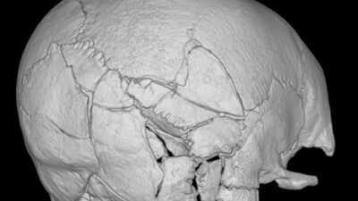 A skeleton found beneath Scotland’s Stirling Castle had more than 160 fractures; researchers say it is the first confirmed death from a trebuchet