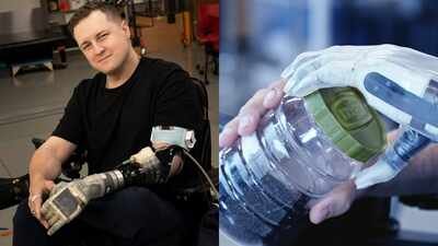 A Florida man lost his left arm after a 35-foot fall at 16; 17 years later, he is the first to take home a thought-controlled bionic arm that can restore his sense of touch
