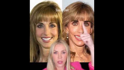 ‘Is that you’: Celebrity cosmetic doctor reacts as Internet can’t stop talking about Susan Dell’s face while she donates billions