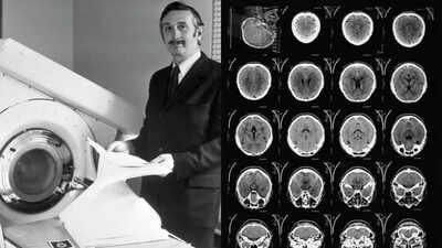 In 1971, engineer Godfrey Hounsfield’s new scanner revealed a brain cyst in the first clinical CT scan; 8 years later, he shared the Nobel Prize for developing computer-assisted tomography