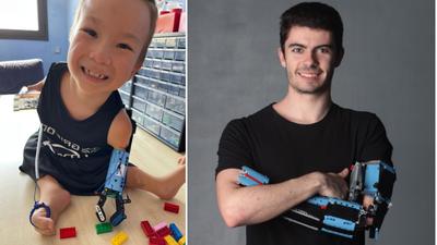 He was born with an underdeveloped arm and faced hurtful comments as a child; at 18, he built a working LEGO prosthetic, helping an 8-year-old boy with similar limb differences | World News